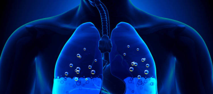Depth-Induced Pulmonary Edema